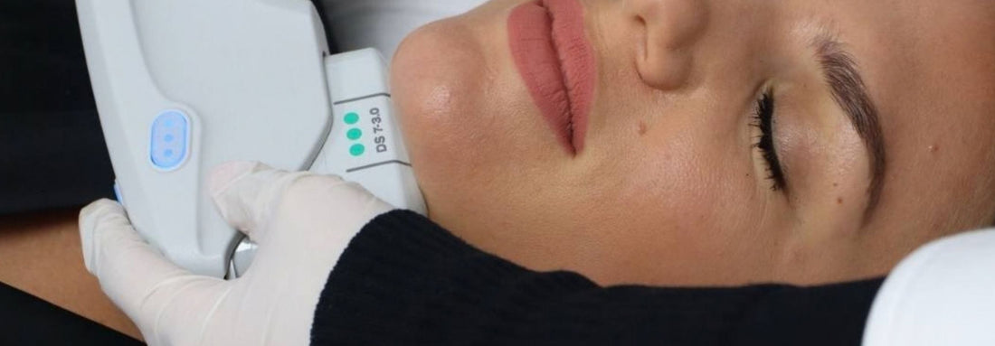 Llegó a RO Medical Ultherapy PRIME: La evolución del lifting sin cirugía - Ro Medical