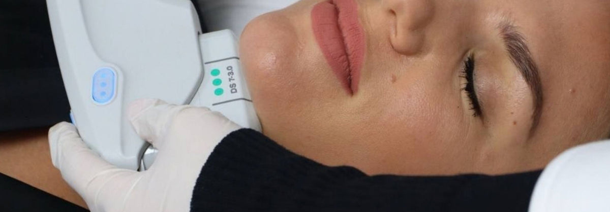 Llegó a RO Medical Ultherapy PRIME: La evolución del lifting sin cirugía - Ro Medical