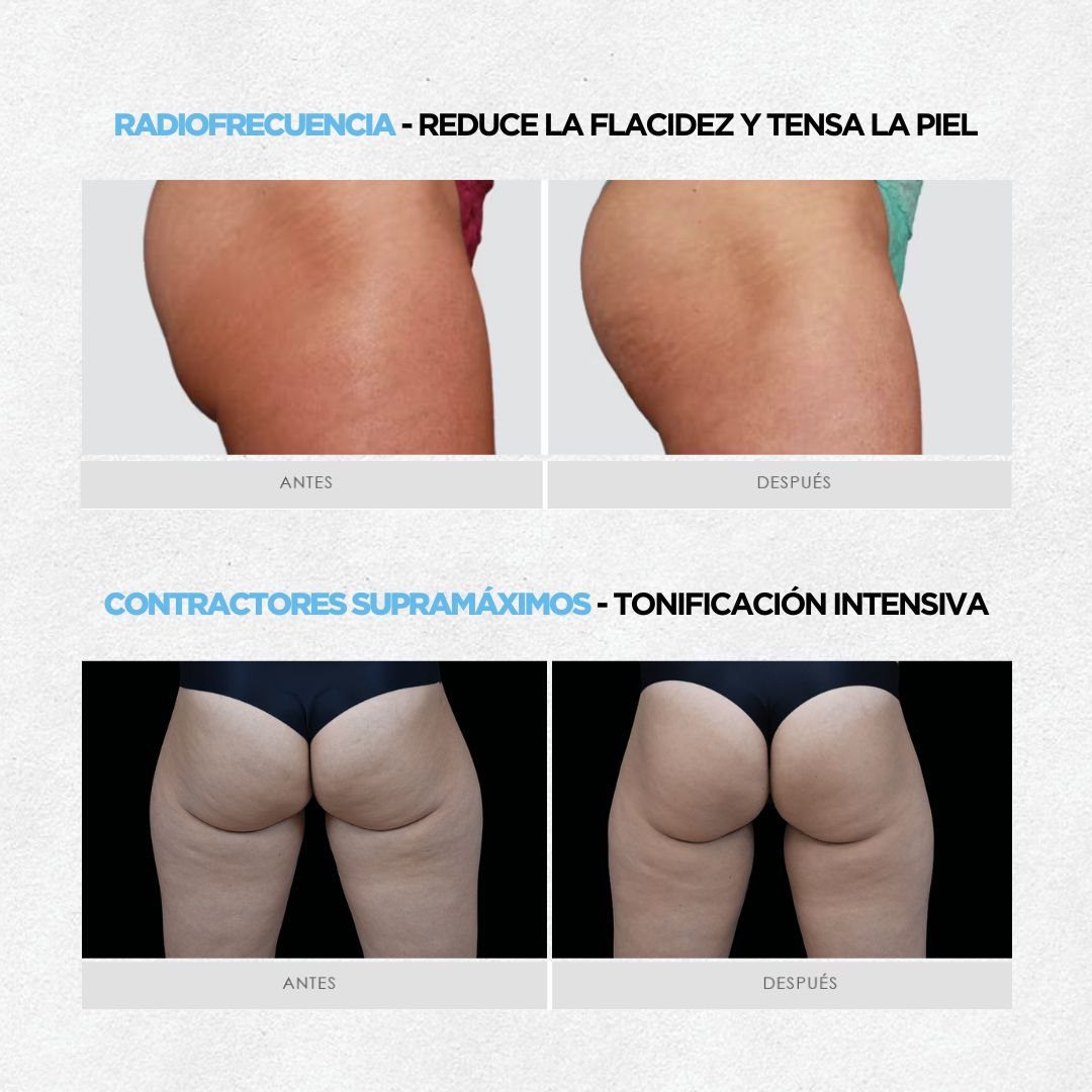 Plan Firmeza: Definición & Tonificación