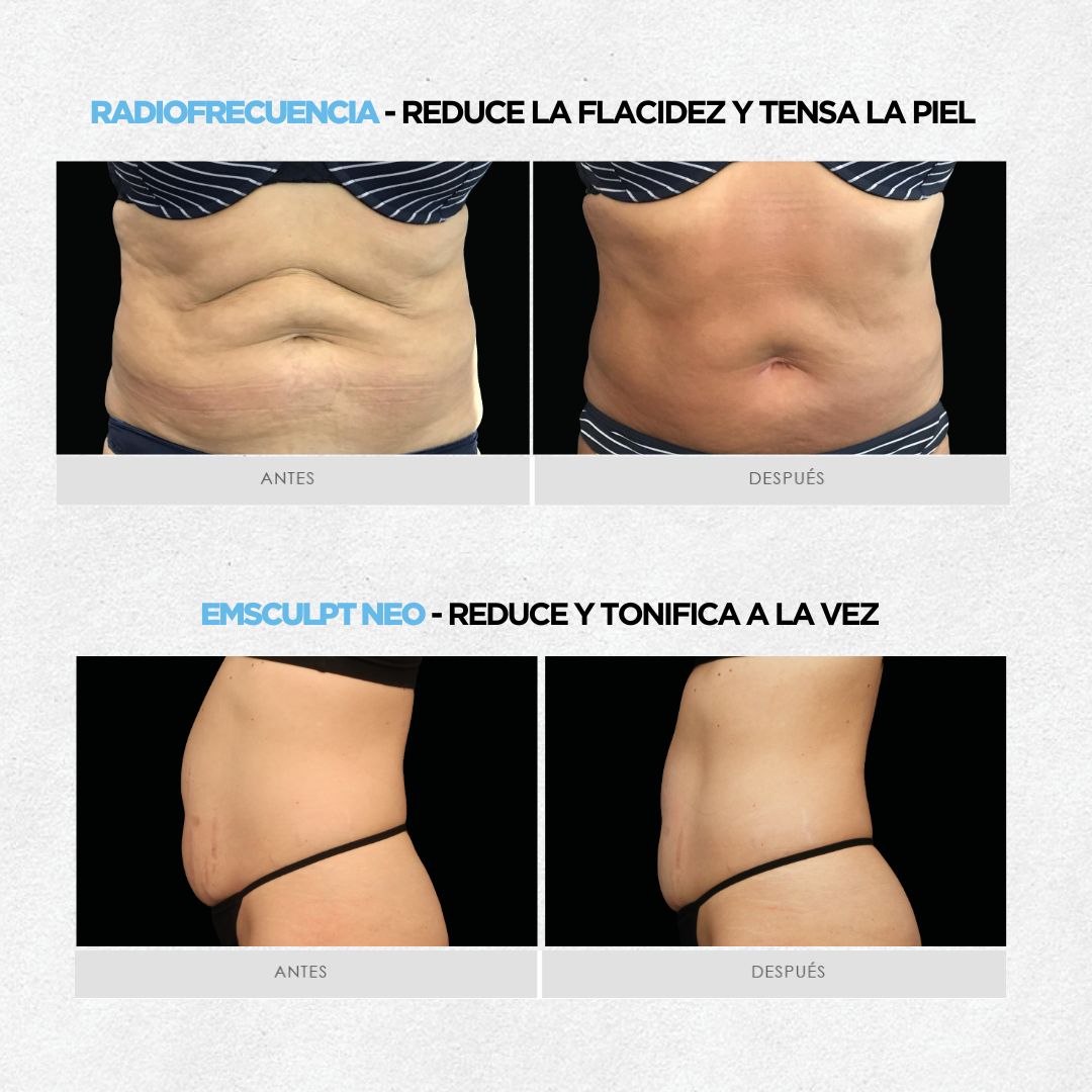 Plan Premium: Definición, Reducción & Tonificación