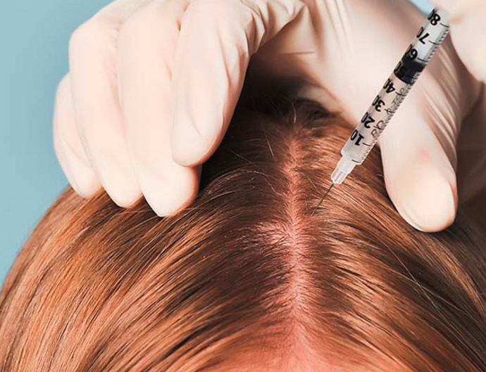 Mesoterapia española RRS XL HAIR (Tratamiento completo - 6 sesiones)