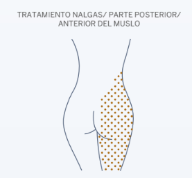 Mesoterapia corporal española Cellutrix - Pack 6 sesiones