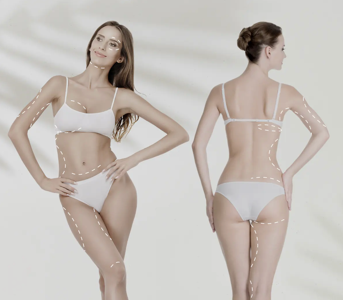 Radiofrecuencia Accent / Venus Legacy