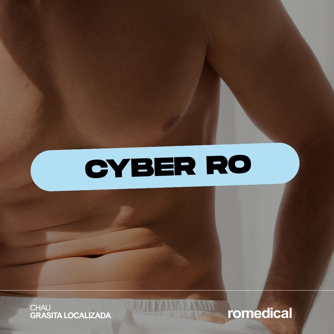 CHAU GRASITA LOCALIZADA - 2 Ciclos de CoolSculpting + 6 Contractores Supramáximos - Ro Medical