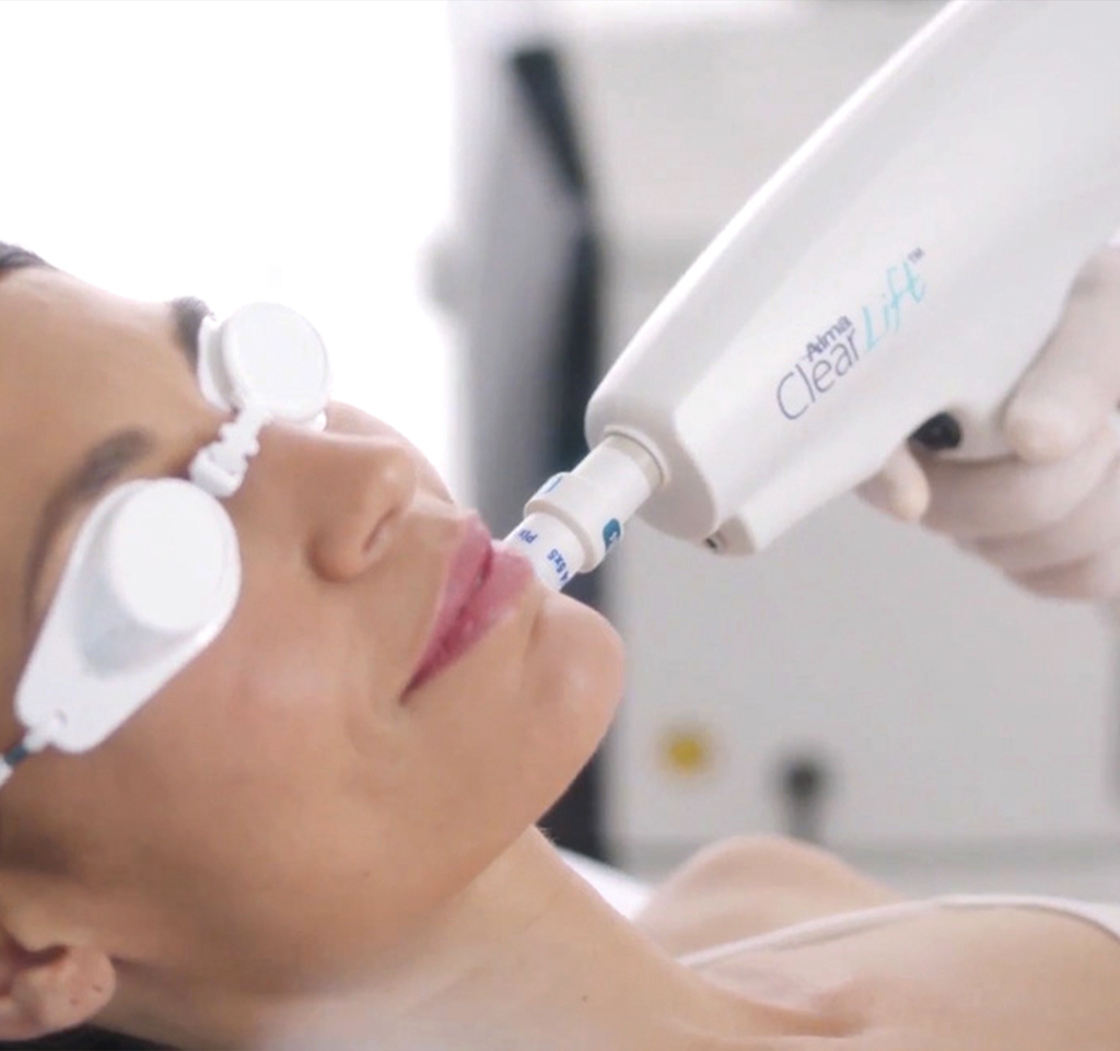 Clear Lift - Rostro 3 sesiones