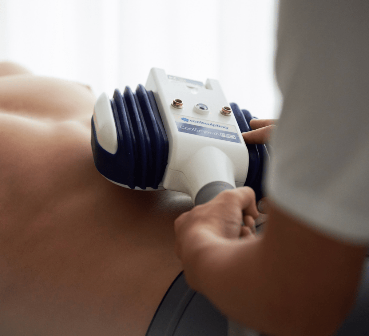 CoolSculpting - 1 Ciclo CoolSmooth - Ro Medical