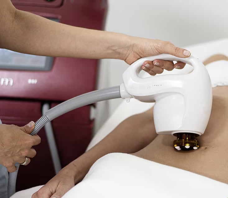 Equipo de radiofrecuencia aplicado en abdomen