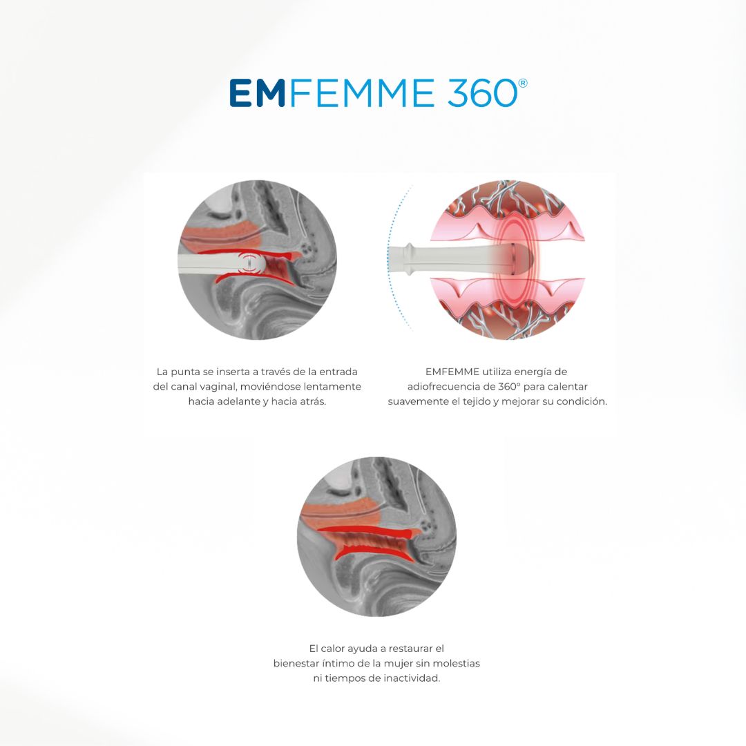 EmFemme - Radiofrecuencia para Zona Íntima