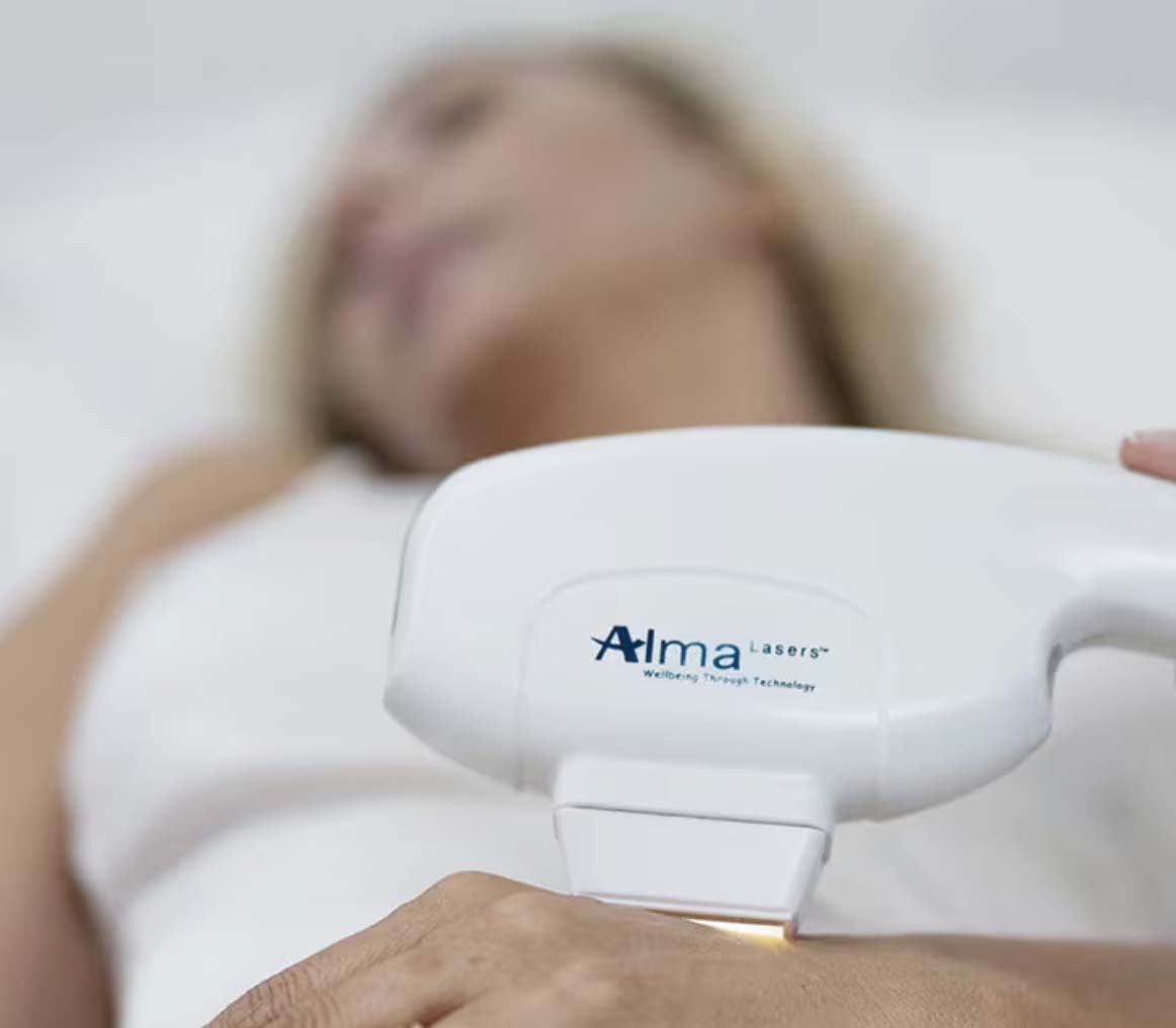 Luz Pulsada - IPL Harmony PRO - Rostro Pack 3 sesiones