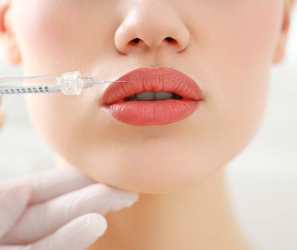 Lip Glow! Aplicación de Ácido Hialurónico en Labios