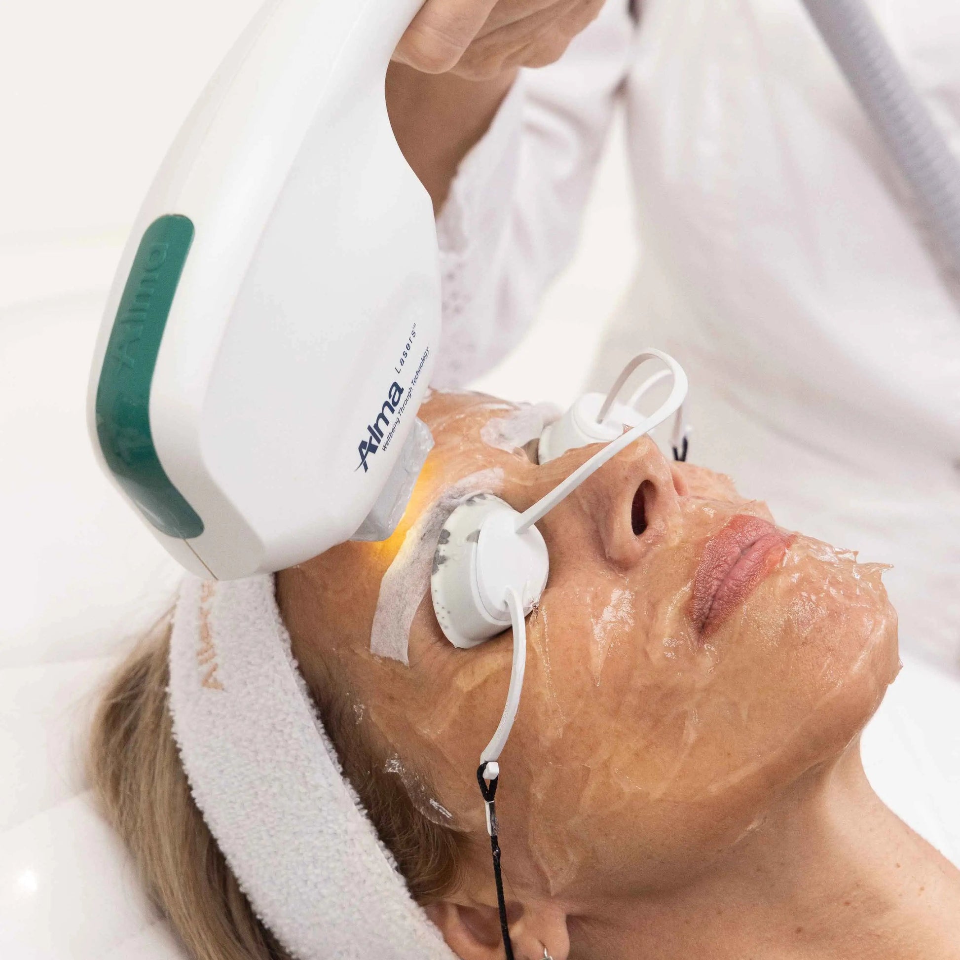 Luz Pulsada IPL - Harmony XL PRO - Ro Medical