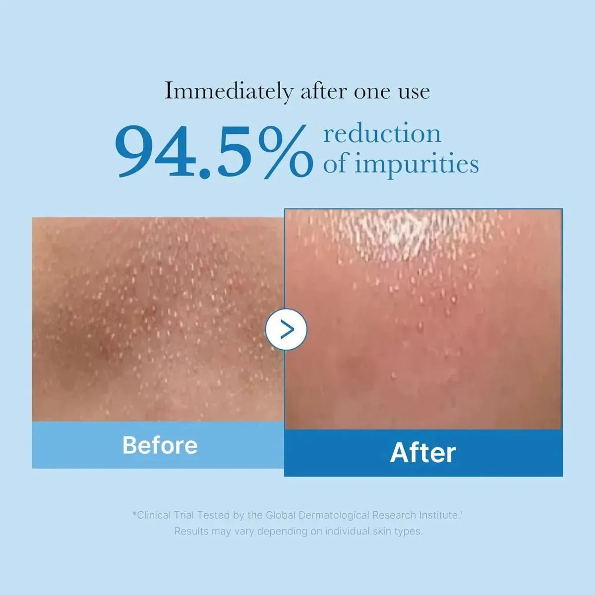 Medicube - Zero Pore Blackhead Deep Cleansing Oil - Ro Medical
