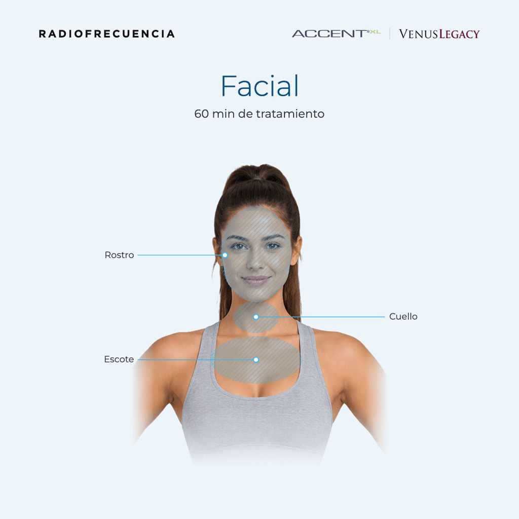 Radiofrecuencia Accent/Venus Legacy - Ro Medical