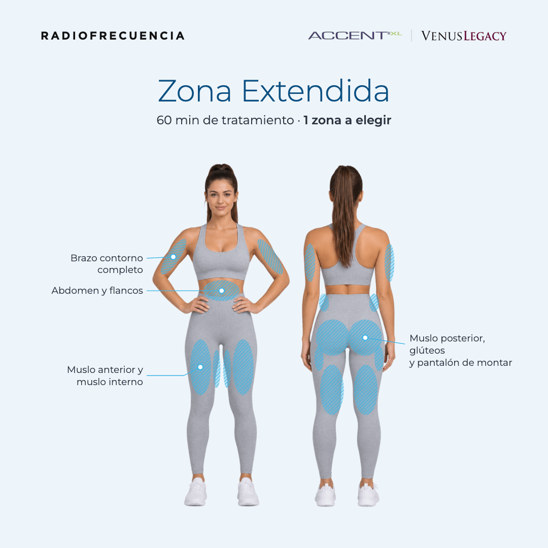 Radiofrecuencia Accent/Venus Legacy - Ro Medical