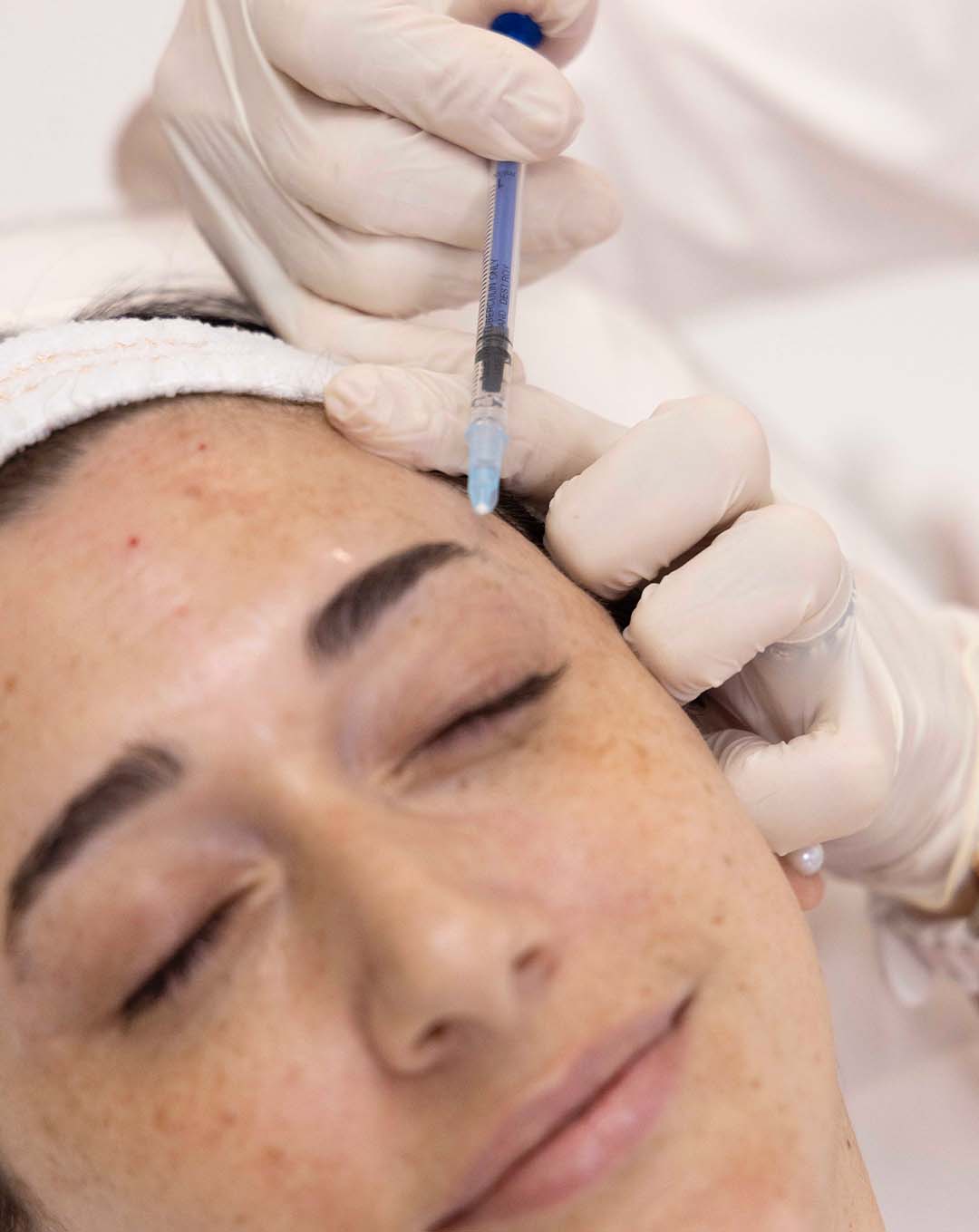 Aplicación de Botox