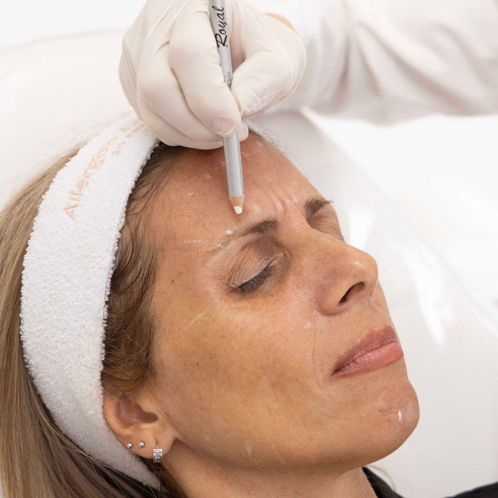 Aplicación de Botox