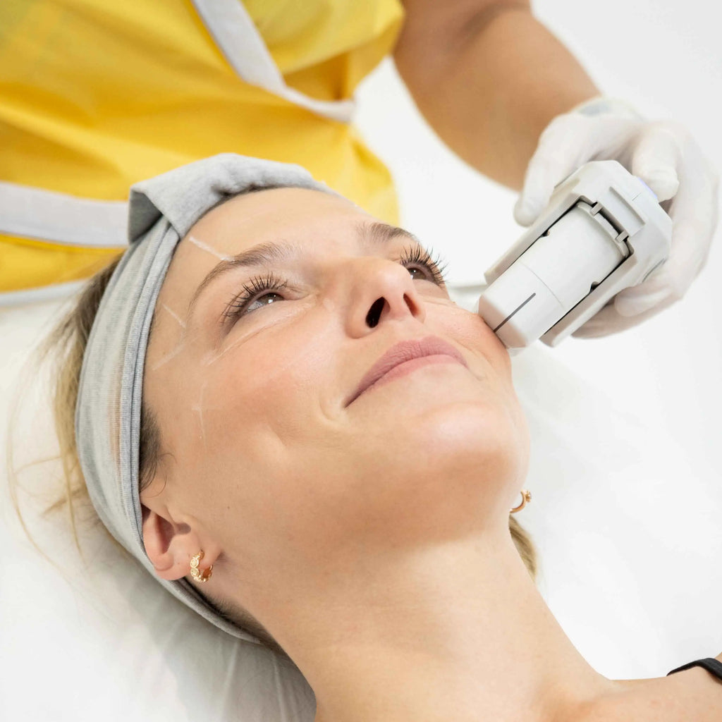 Ultherapy - Lifting sin cirugía - Rostro Completo 800 lÍneas