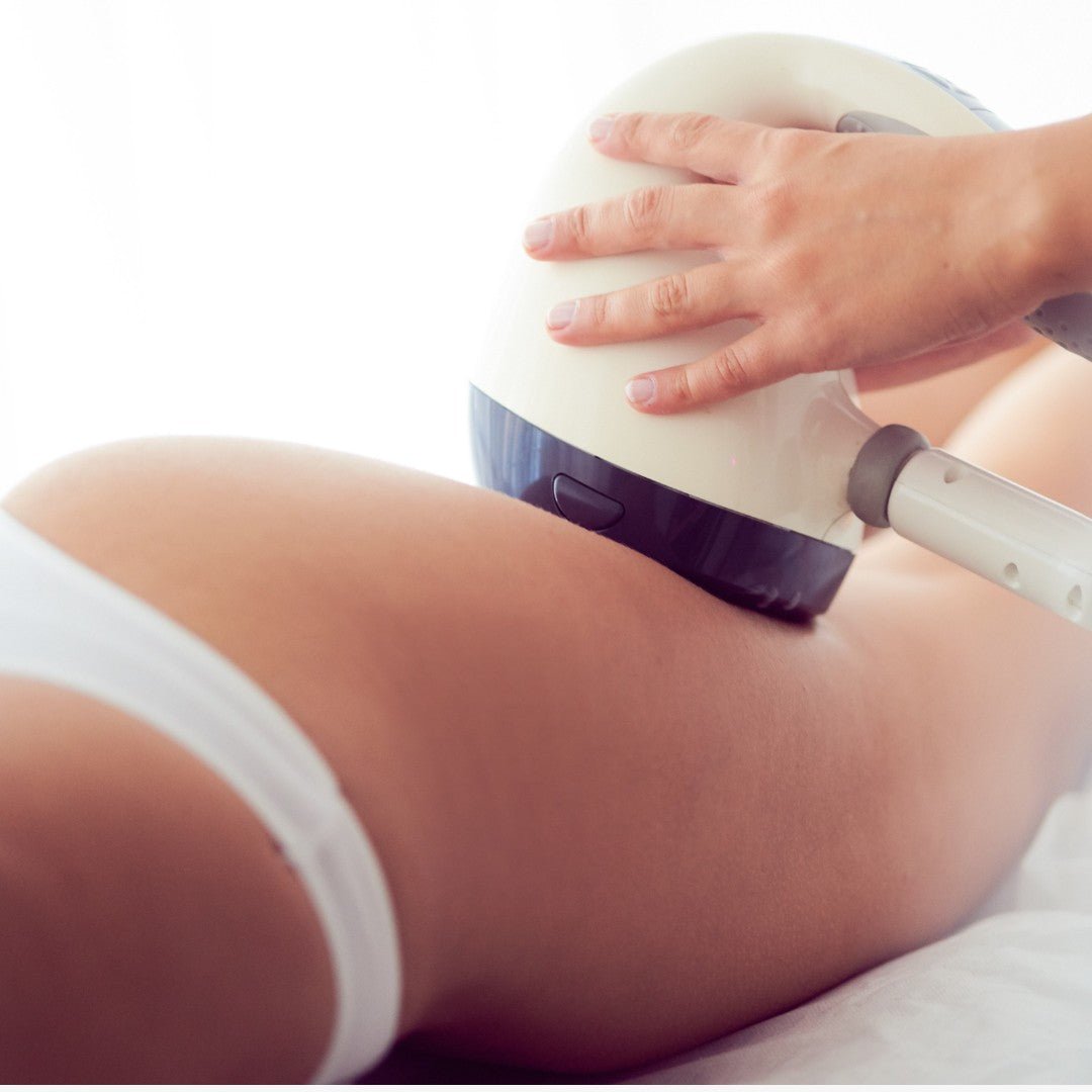 VelaShape 2 - Ro Medical